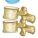 Лечение заболеваний позвоночника