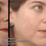 Помогу избавиться от аллергии