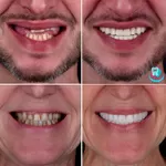 Клініка Са-Ната: високоякісне лікування зубів у Києві