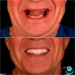 Професійна імплантація зубів у місті Київ - Са-Ната