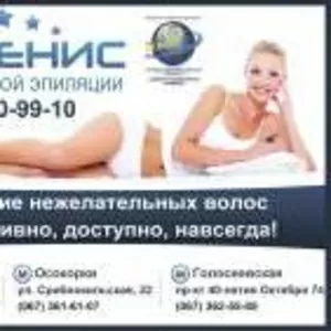 Лазерная эпиляция