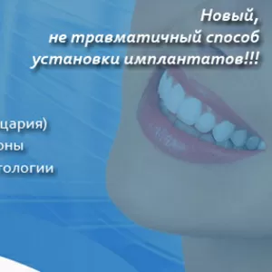 Новый,  не травматичный способ установки имплантатов!