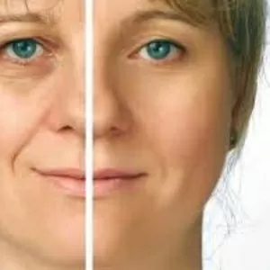 Скульптурно – глубокотканный  массаж лица  (лифтинг)