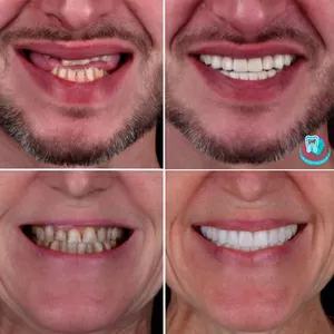 Клініка Са-Ната: високоякісне лікування зубів у Києві