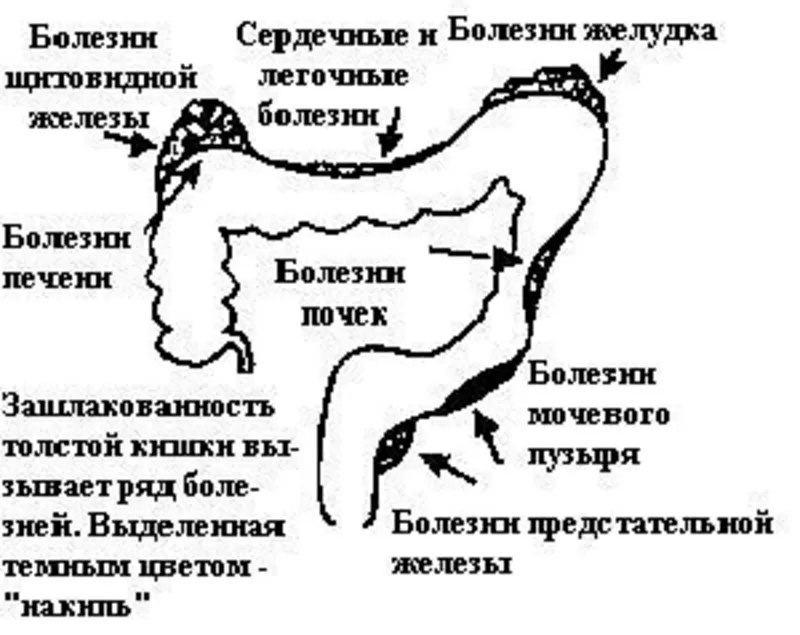 Очистка организма,  снижение веса 067-765-22-25