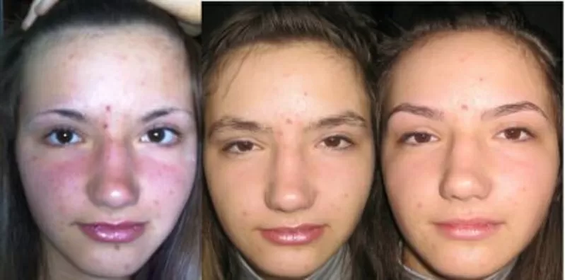 Профессиональная коррекция бровей 9