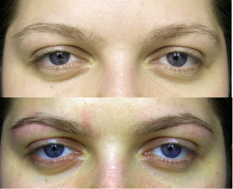 Профессиональная коррекция бровей 24