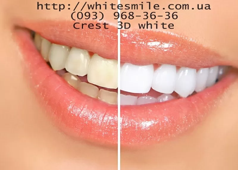 Полоски crest 3d white купить crest whitestrips Украина отзывы.