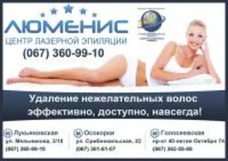 Лазерная эпиляция