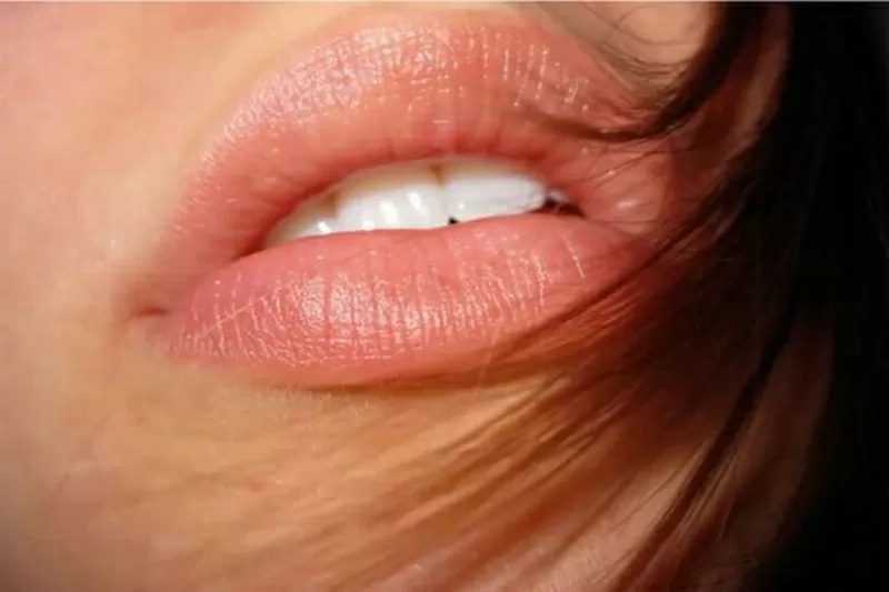 Контурная пластика лица, увеличение губ, увеличение скул, коррекция формы 3