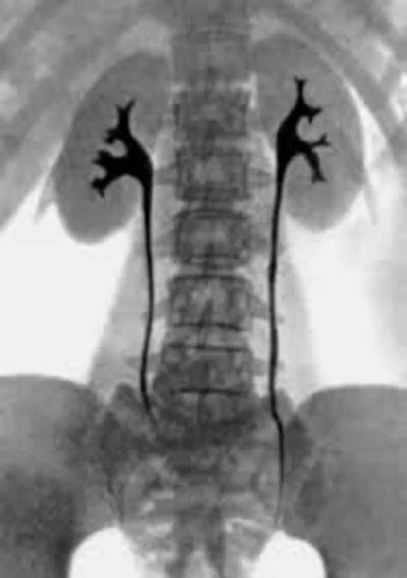 Контрастные рентген исследования детям, взрослым 2