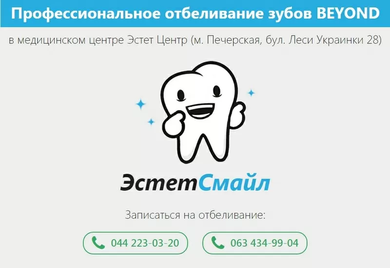 Отбеливание зубов системой Beyond Polus в Киеве в ЭстетСмайл 4