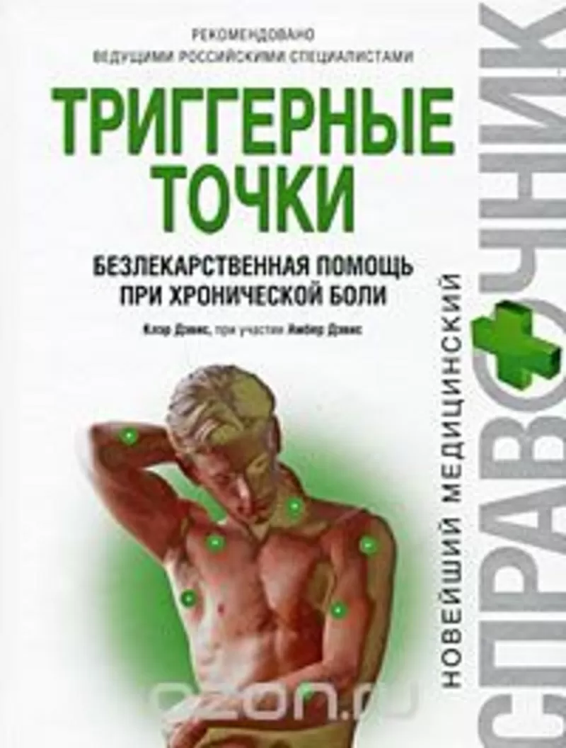 Триггерные точки