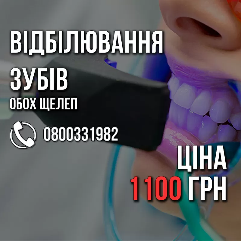 Відбілювання зубів ВСЬОГО 1100 грн. +Поверхнева чистка БЕЗКОШТОВНО. 