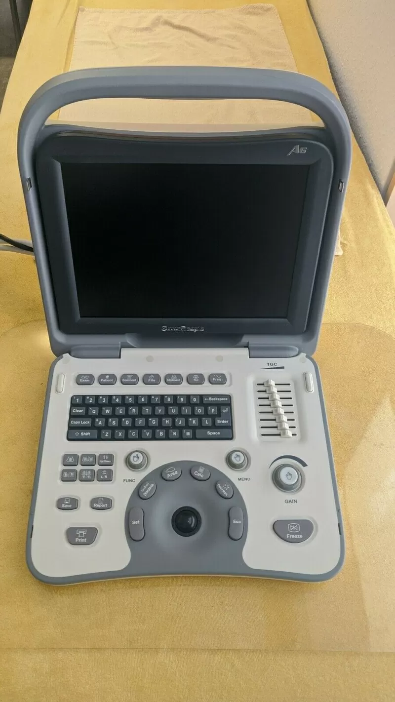 продам портативный узи узд сканер апарат Sonoscape A6V A6 c датчиком 5